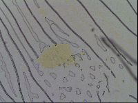 Testechiniscus laterculus image