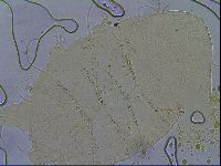 Testechiniscus laterculus image