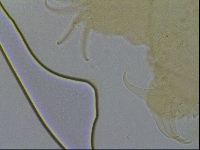 Testechiniscus laterculus image