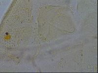 Testechiniscus laterculus image