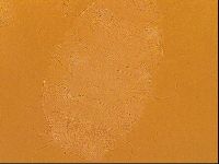 Testechiniscus laterculus image
