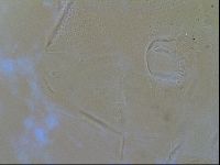 Testechiniscus laterculus image