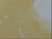 Testechiniscus laterculus image