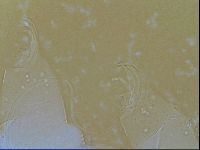 Testechiniscus laterculus image