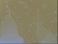 Testechiniscus laterculus image