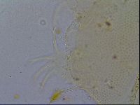 Testechiniscus laterculus image