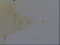 Testechiniscus laterculus image
