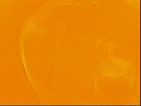 Testechiniscus laterculus image
