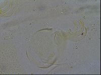 Testechiniscus laterculus image