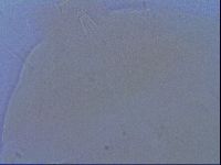 Testechiniscus laterculus image