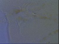 Testechiniscus laterculus image