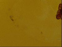 Testechiniscus laterculus image