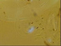 Testechiniscus laterculus image