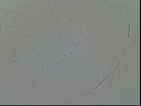 Testechiniscus laterculus image