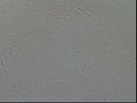 Testechiniscus laterculus image