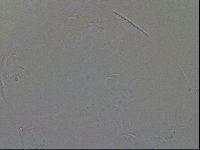 Testechiniscus laterculus image