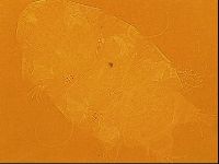 Testechiniscus laterculus image