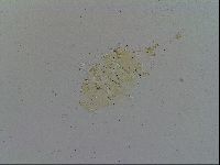 Testechiniscus laterculus image