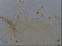 Testechiniscus laterculus image