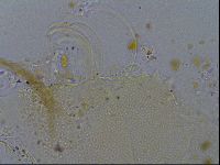 Testechiniscus laterculus image
