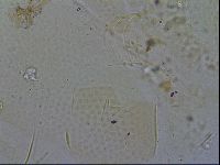 Testechiniscus laterculus image