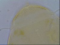 Testechiniscus laterculus image