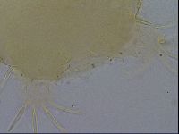 Testechiniscus laterculus image