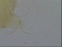 Testechiniscus laterculus image
