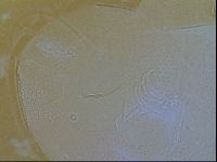 Testechiniscus laterculus image