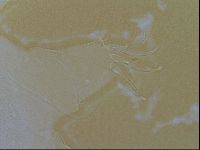 Testechiniscus laterculus image