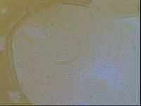 Testechiniscus laterculus image