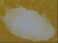 Testechiniscus laterculus image