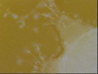 Testechiniscus laterculus image