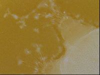 Testechiniscus laterculus image