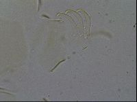 Testechiniscus laterculus image