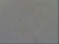 Testechiniscus laterculus image