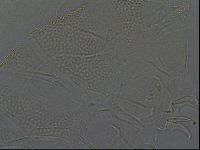 Testechiniscus laterculus image