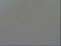 Testechiniscus laterculus image
