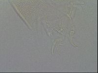 Testechiniscus laterculus image