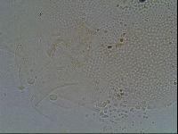 Testechiniscus laterculus image