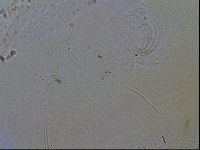 Testechiniscus laterculus image