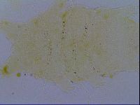 Testechiniscus laterculus image