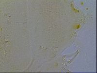 Testechiniscus laterculus image