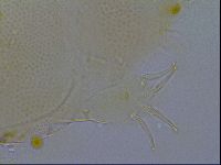 Testechiniscus laterculus image