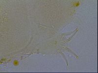 Testechiniscus laterculus image