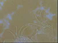 Testechiniscus laterculus image