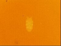 Testechiniscus laterculus image