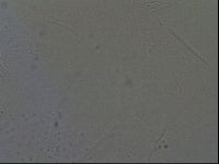 Testechiniscus laterculus image