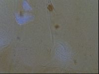 Testechiniscus laterculus image