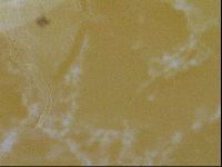Testechiniscus laterculus image